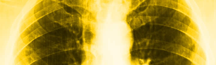 Image of an x-ray